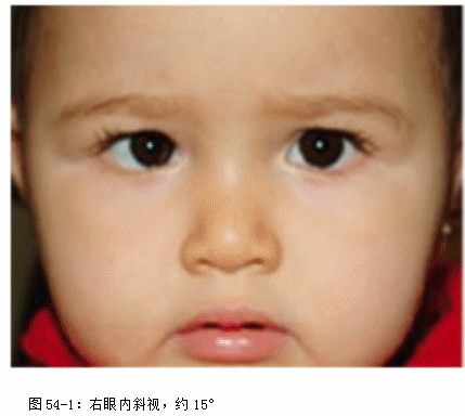 ZY016_285_2.gif
